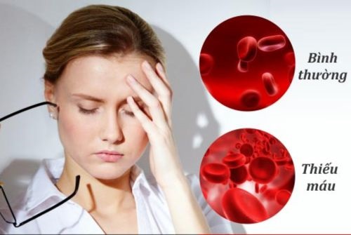 Thiếu máu là triệu chứng u xơ cổ tử cung