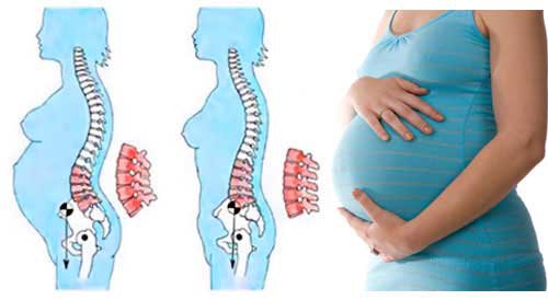 Dấu hiệu đau lưng khi mới mang thai
