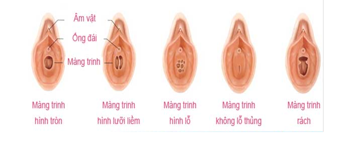Mang Trinh Cac Loai