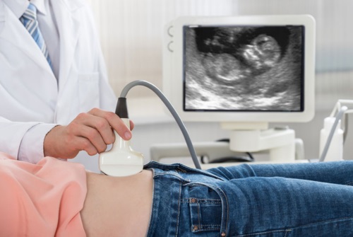 Siêu âm chẩn đoán thai ngoài tử cung
